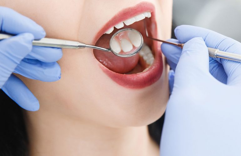 10 Cose Che Non Sapevi Sulla Prevenzione Delle Patologie Del Cavo Orale