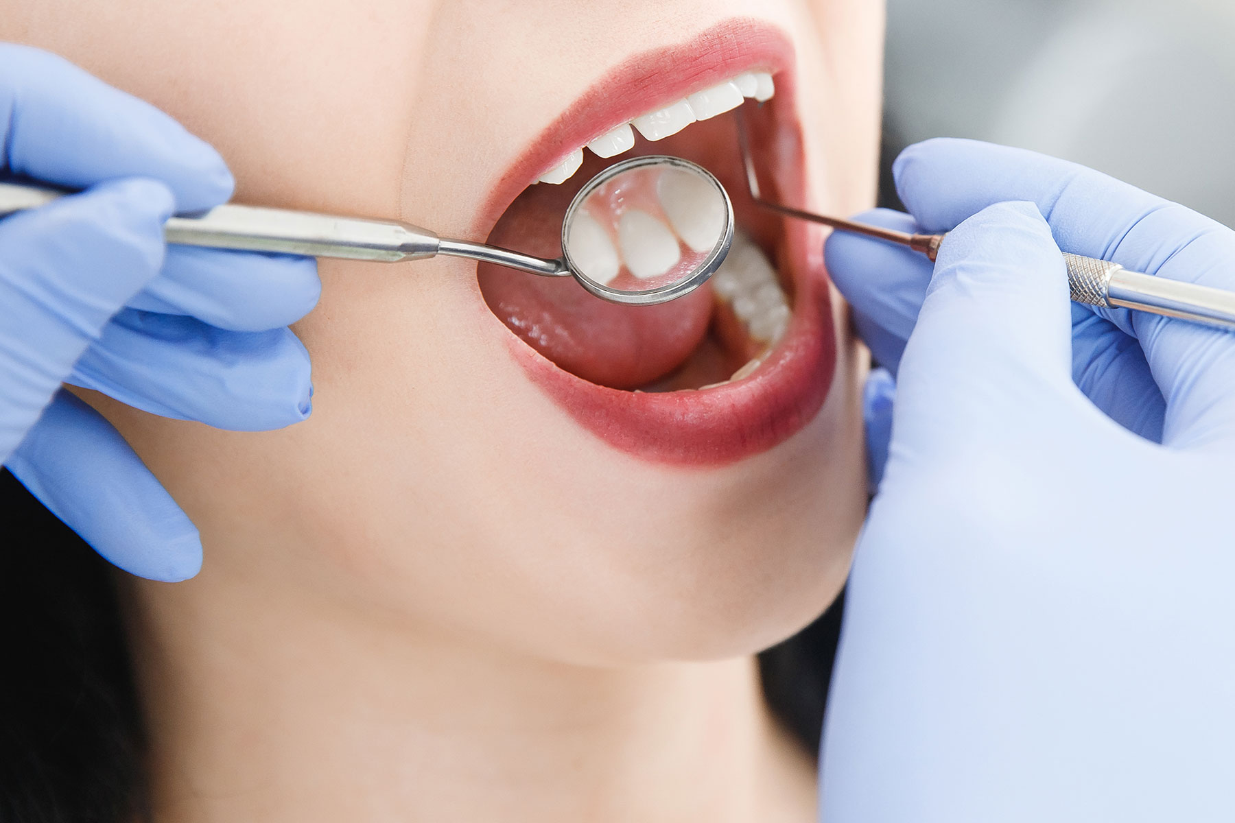 10 Cose Che Non Sapevi Sulla Prevenzione Delle Patologie Del Cavo Orale