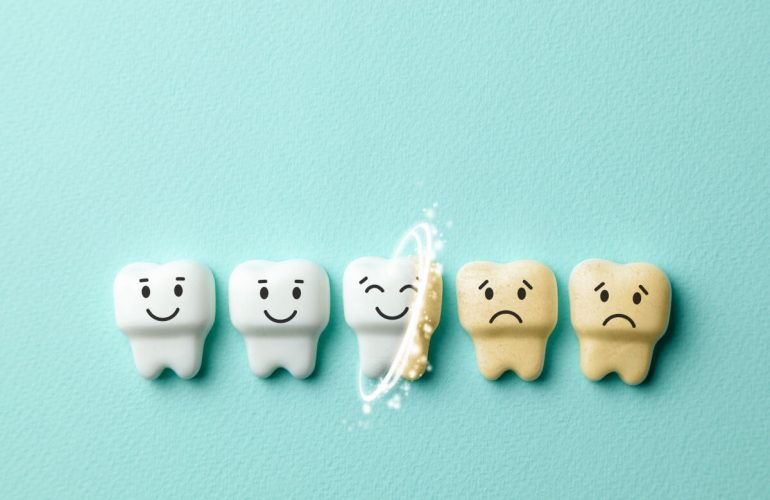 macchie dentali alcune si tolgono altre no