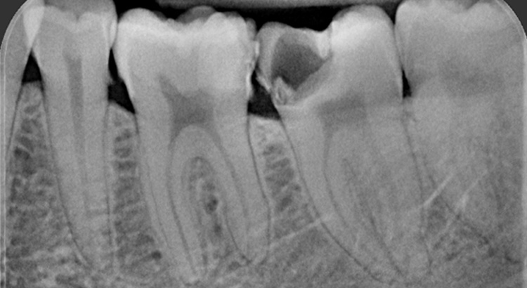 endodonzia prima