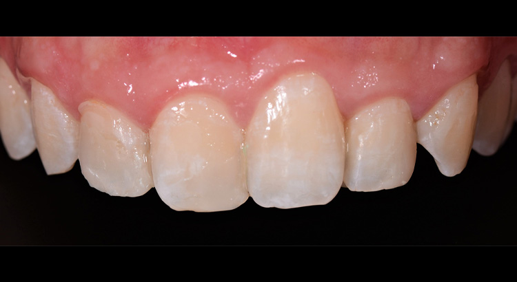 risultato odontoiatria estetica