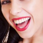 sbiancamento dentale professionale