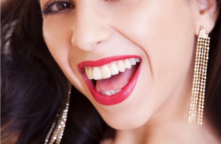 sbiancamento dentale professionale