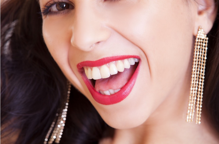 sbiancamento dentale professionale